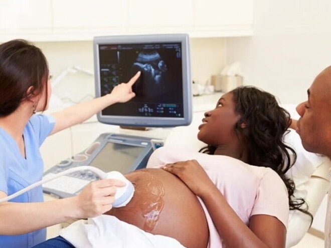 Ectopic pregnancy, Pregnant woman on ultrasound looking at her baby.
